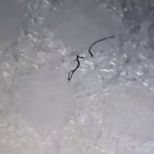 Worms in Face Masks?